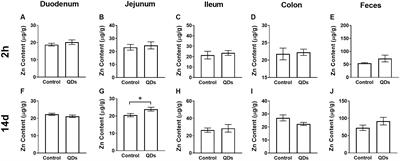 Effects of Oral Exposure to Mn-Doped ZnS Quantum Dots on Intestinal Tract and Gut Microbiota in Mice